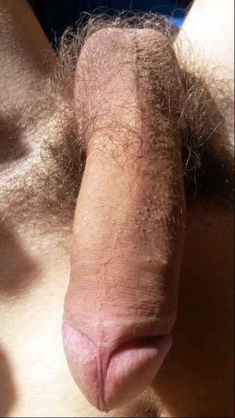 Mydick.